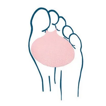 Fortuna jastuče za metatarzalni deo stopala FT-1280-1 Fortuna jastuče za metatarzalni deo stopala FT-1280-1